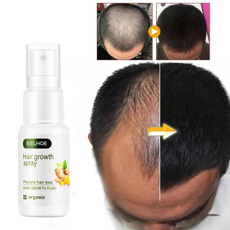 Product thumbnail 4